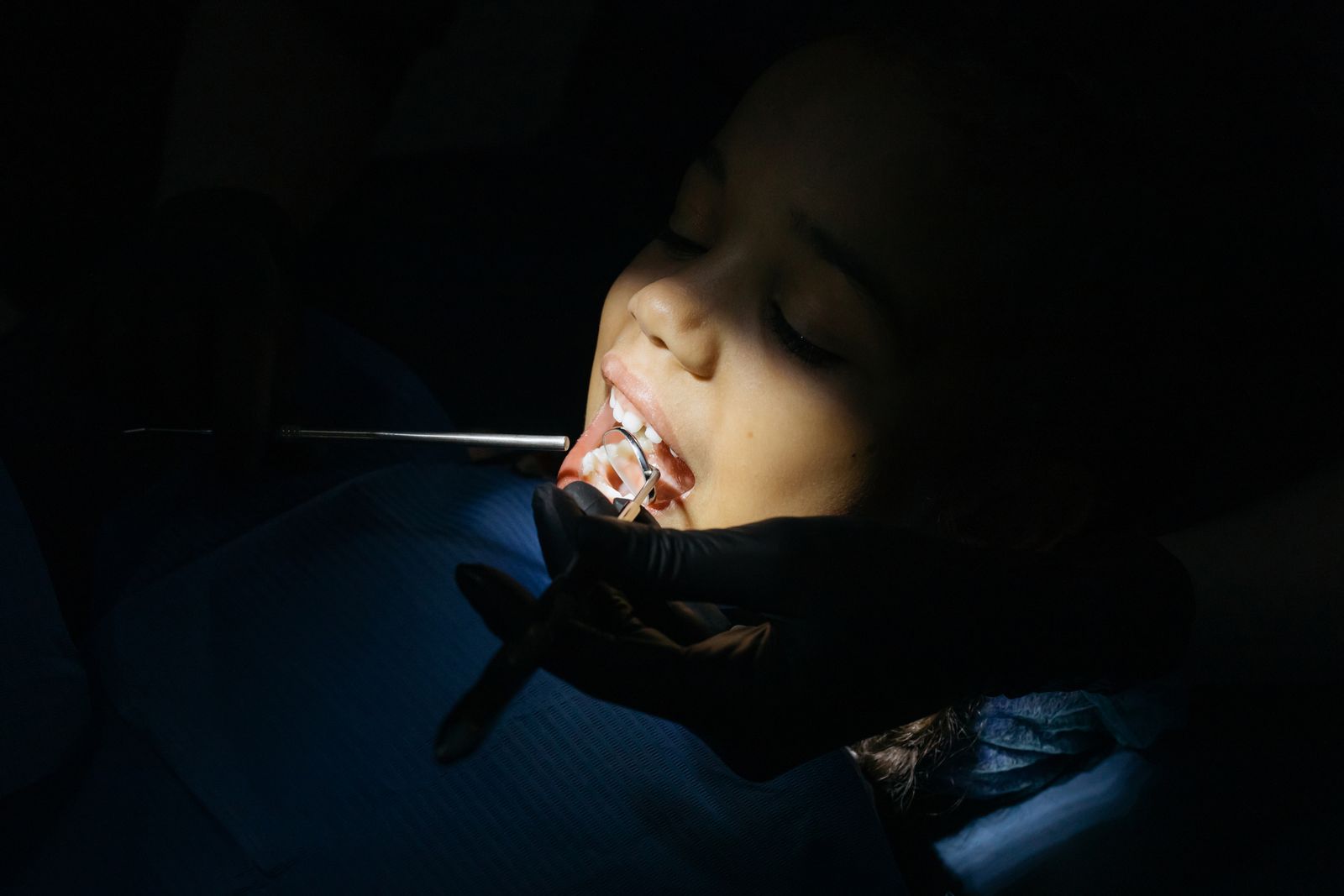 Close-up of a child during a dental exam